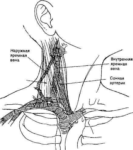 Яремная подключичная вены. Катетеризация яремной вены топографическая анатомия. Внутренняя яремная Вена пункция. Внутренняя яремная Вена катетеризация. Техника катетеризации внутренней яремной вены.